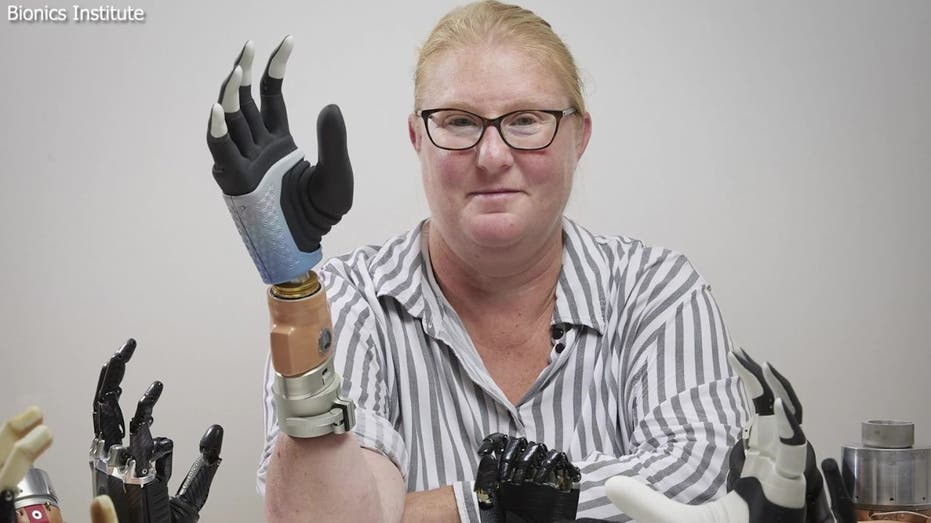 1 Meet The First Person To Ever Receive A Fully Functional Prosthetic Hand With AI Meet The First Person To Ever Receive A Fully Functional Prosthetic Hand With AI Farmer With Mia Hand R3oYwy 